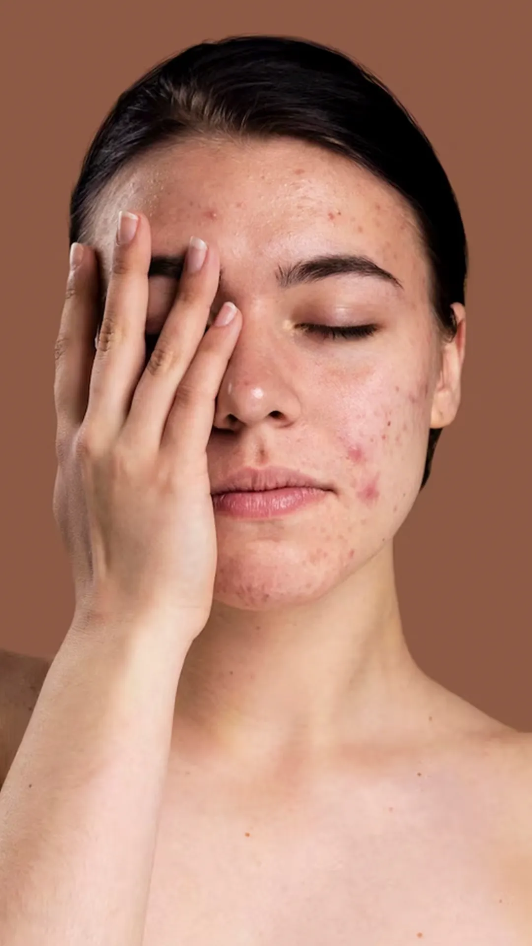 दाग-धब्बों के जिद्दी निशान मिटाने के लिए चेहरे पर क्या लगाएं?