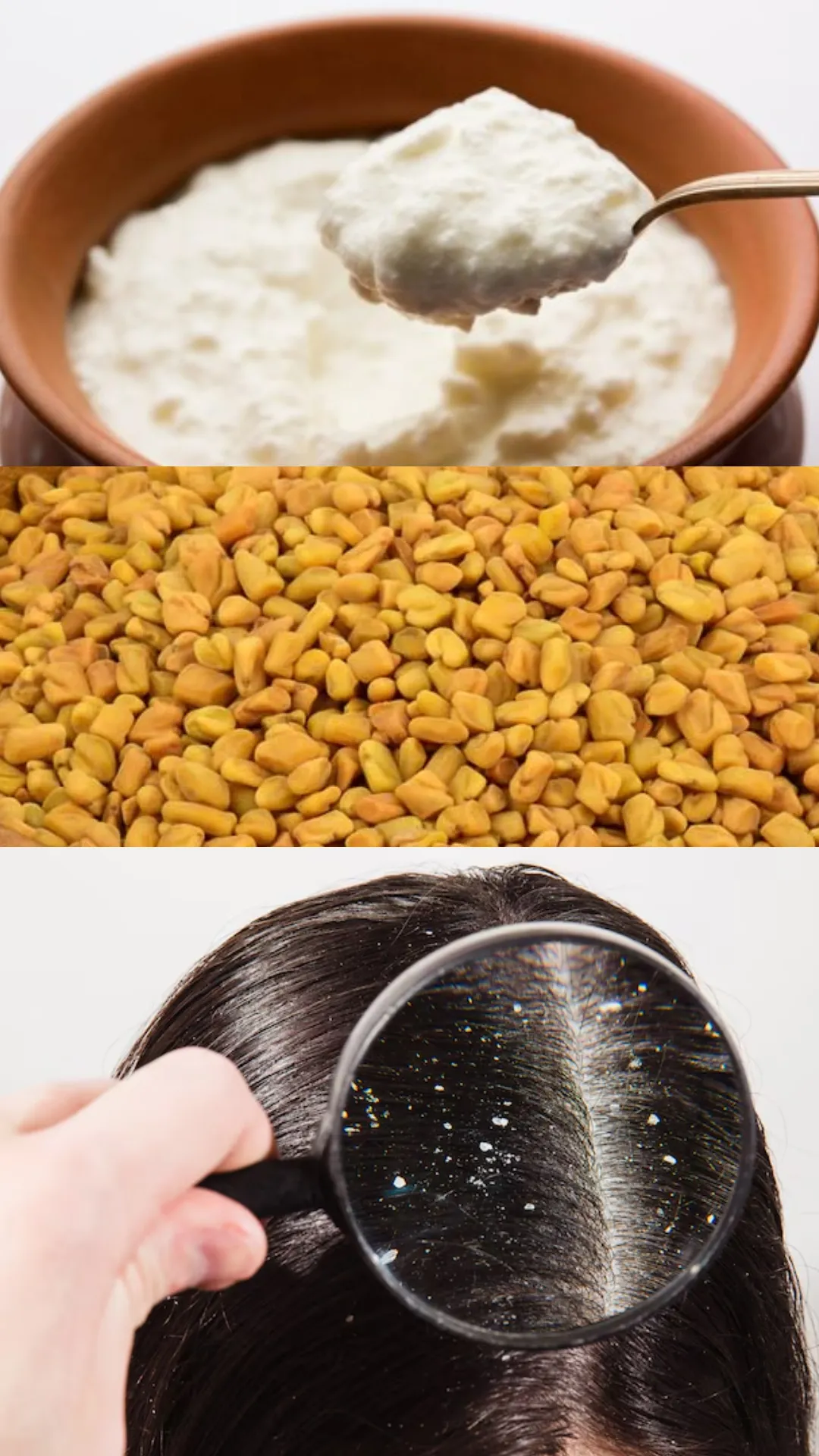 मेथी और गाढ़ी दही वाला उपाय, रूसी और झड़ते पर लगाएगा लगाम