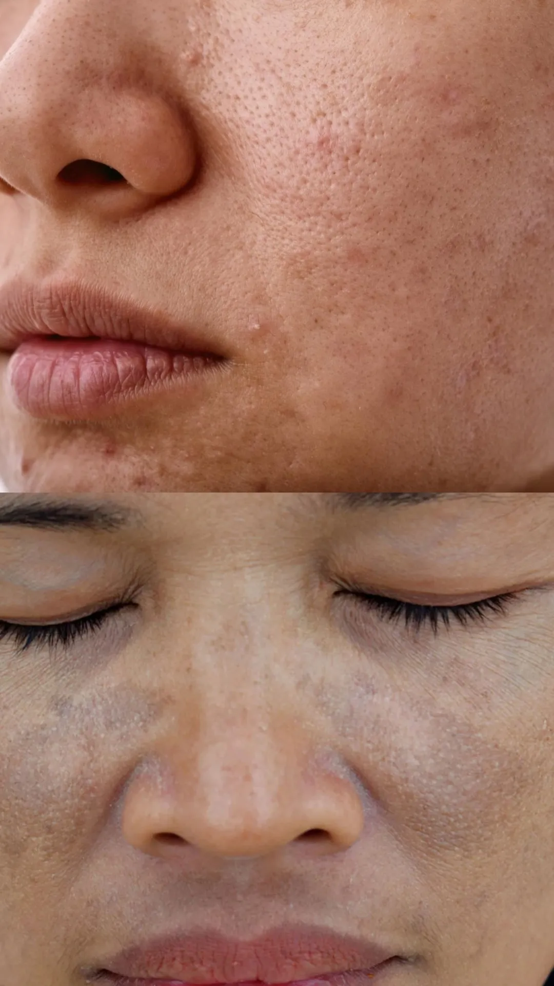 डल, ड्राई और बेजान स्किन से छुटकारा दिलाते हैं ये घरेलू उपाय 