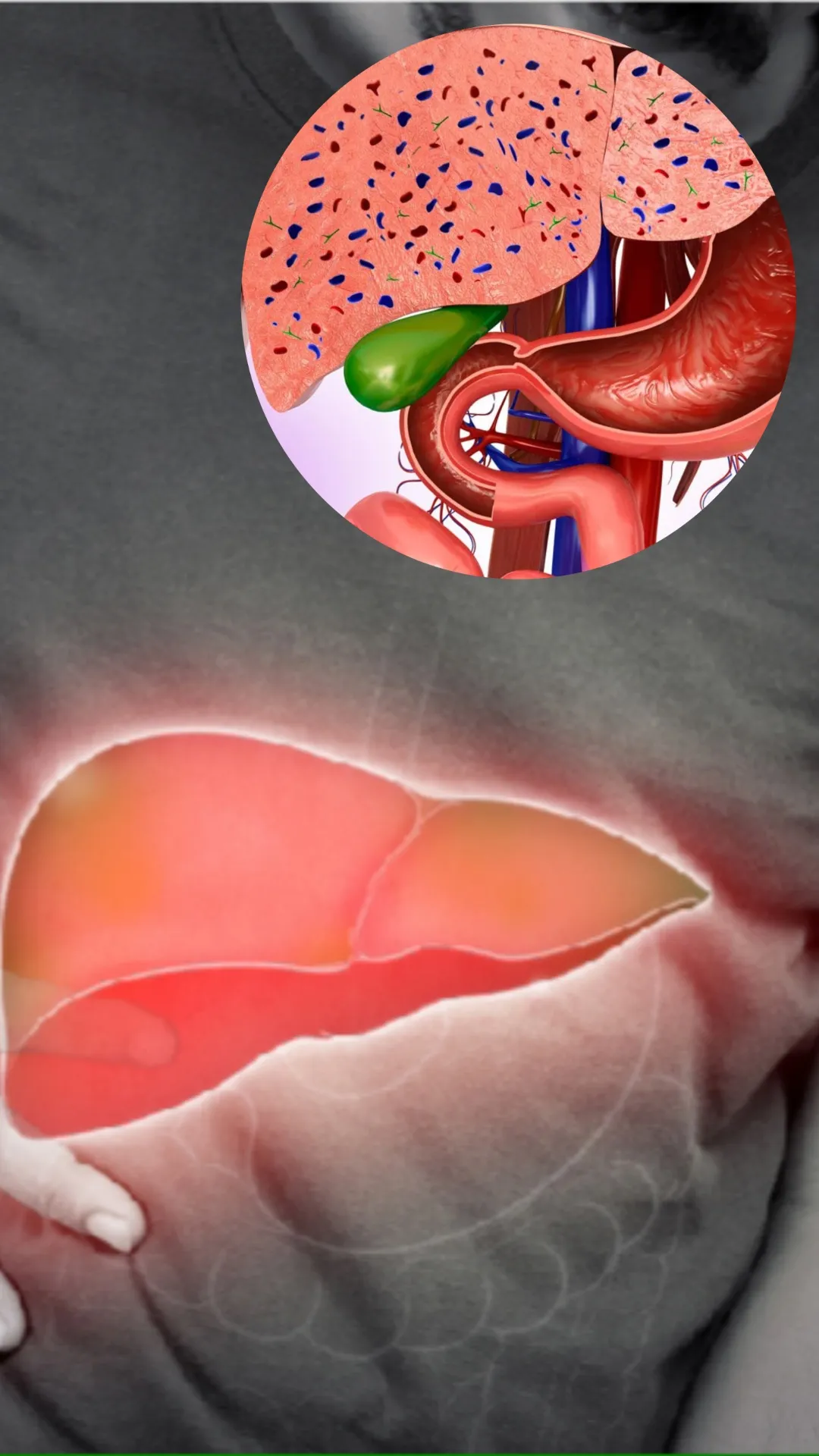 लिवर में सूजन आने के क्या कारण हैं?