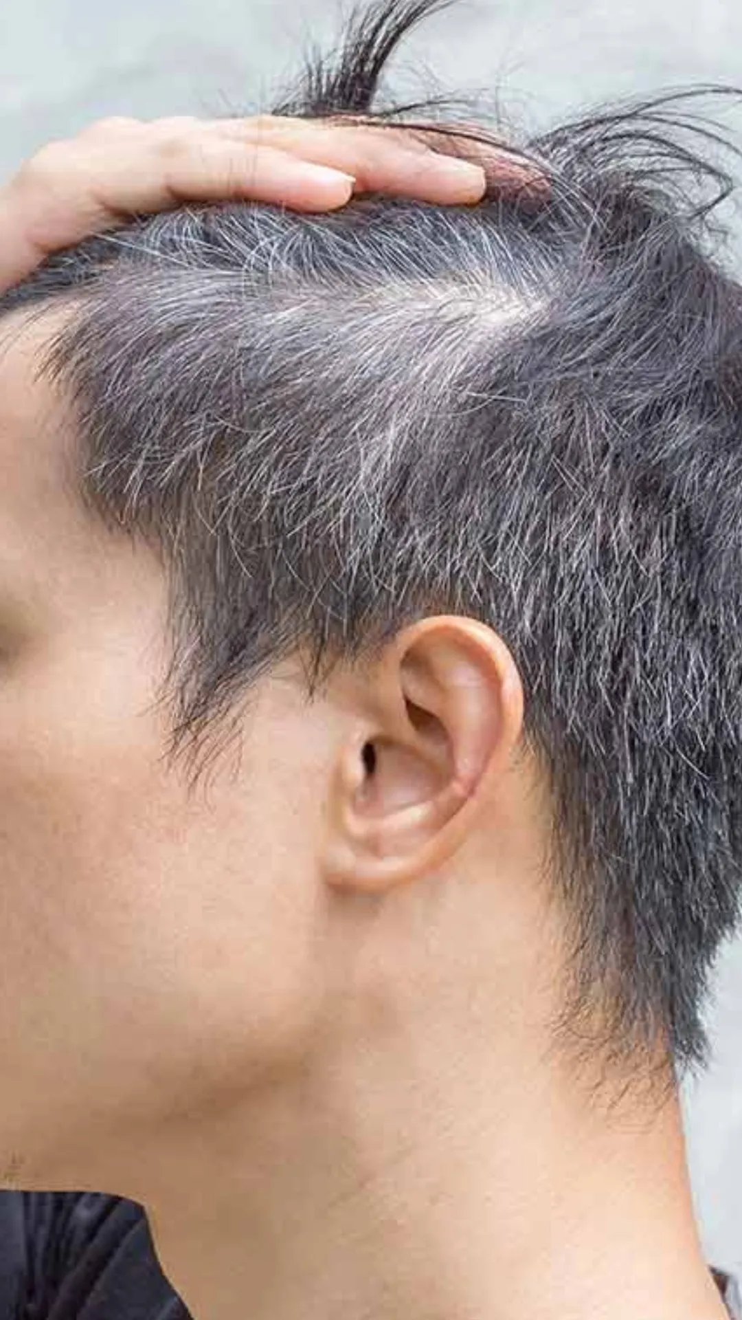 किस विटामिन की कमी से कम उम्र में बाल होने लगते हैं सफेद? 
