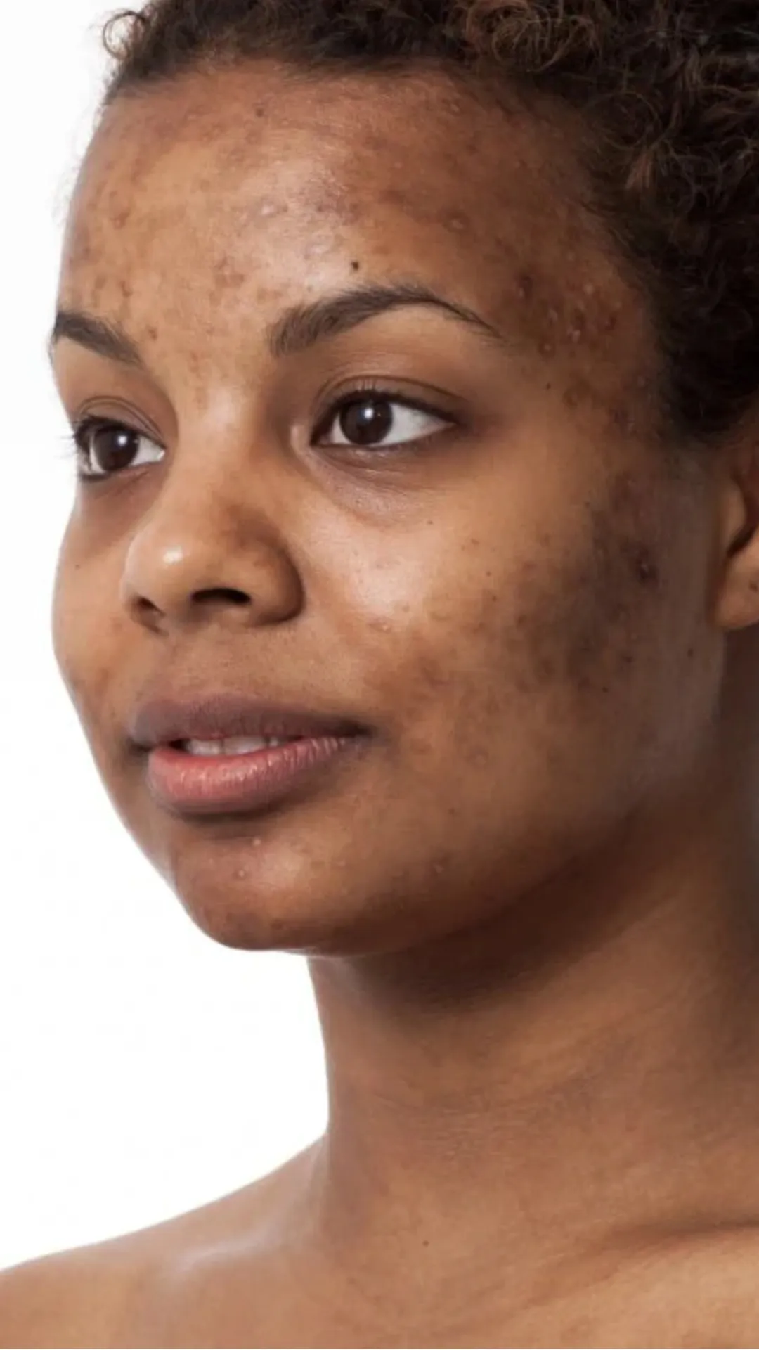 चेहरे पर अचानक कालापन आने का क्या कारण है?