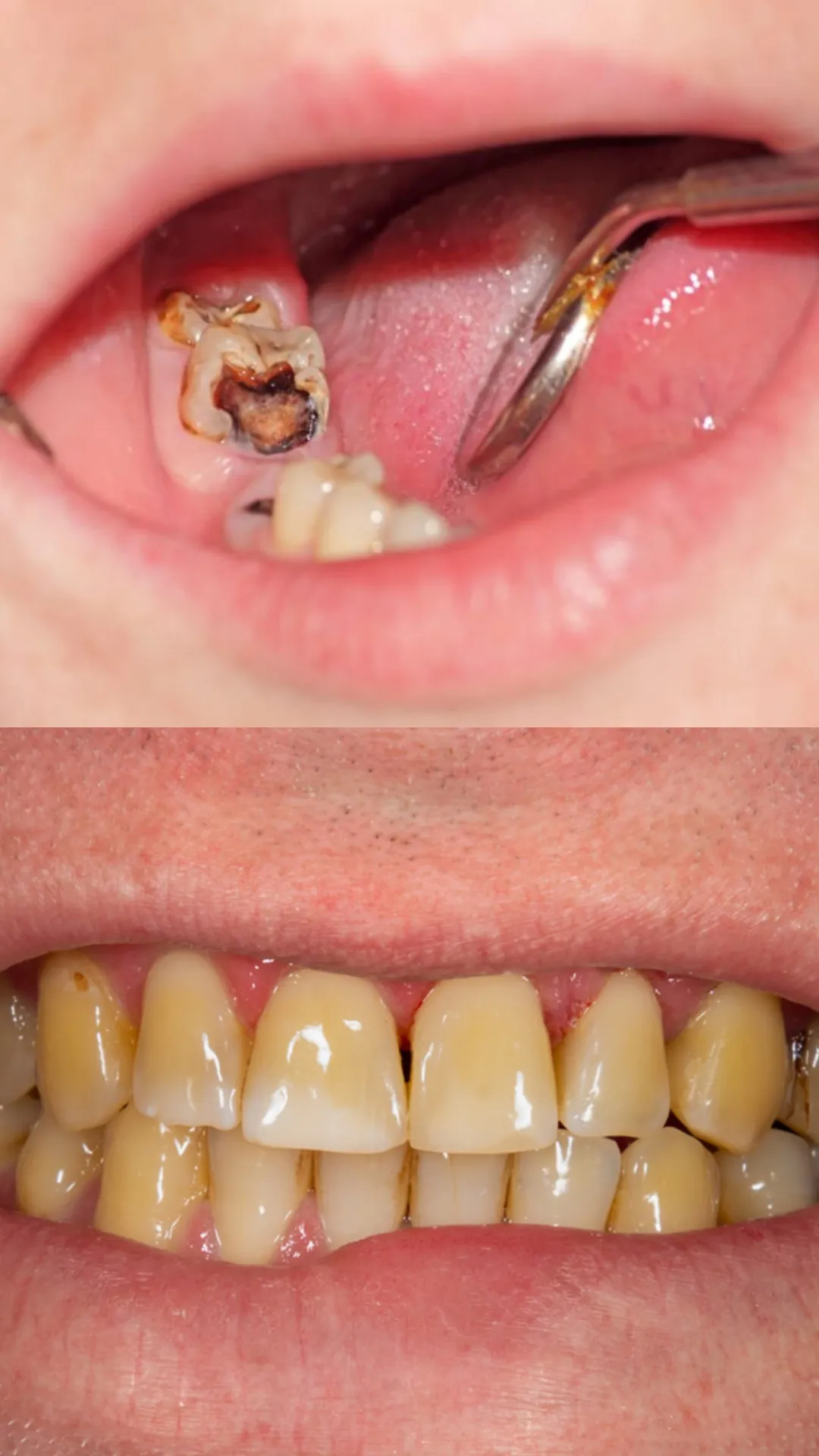 दांतों को सड़ने से बचाएंगे ये उपाय