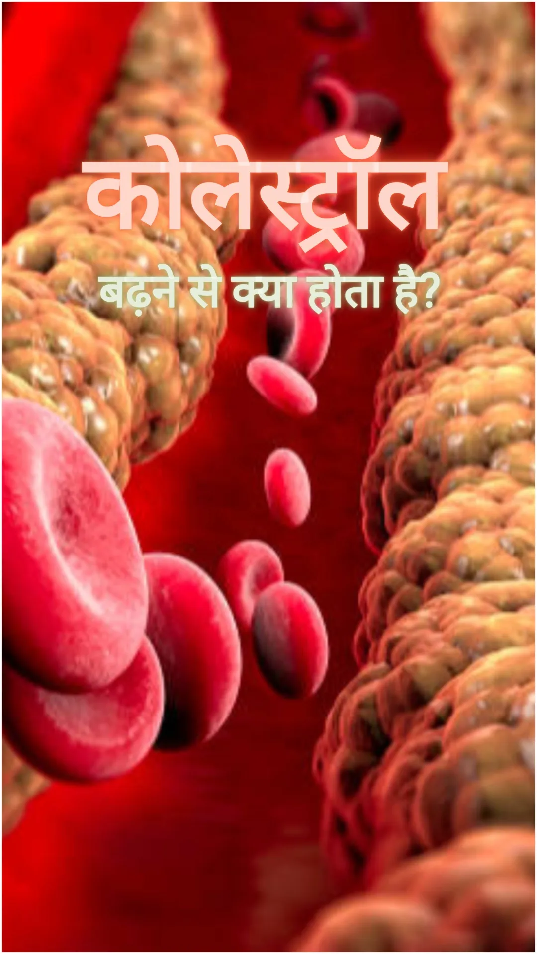 कोलेस्ट्रॉल बढ़ने से शरीर में क्या दिक्कत होती है?