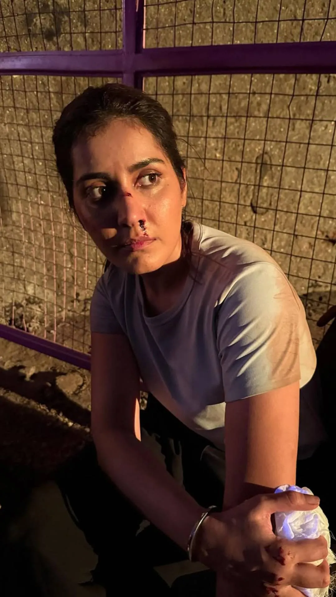 नाक से बहता खून, चेहरे का बुरा हाल, एक रोल के लिए दर्द से गुजरी एक्ट्रेस, सेट से शेयर कीं तस्वीरें 
