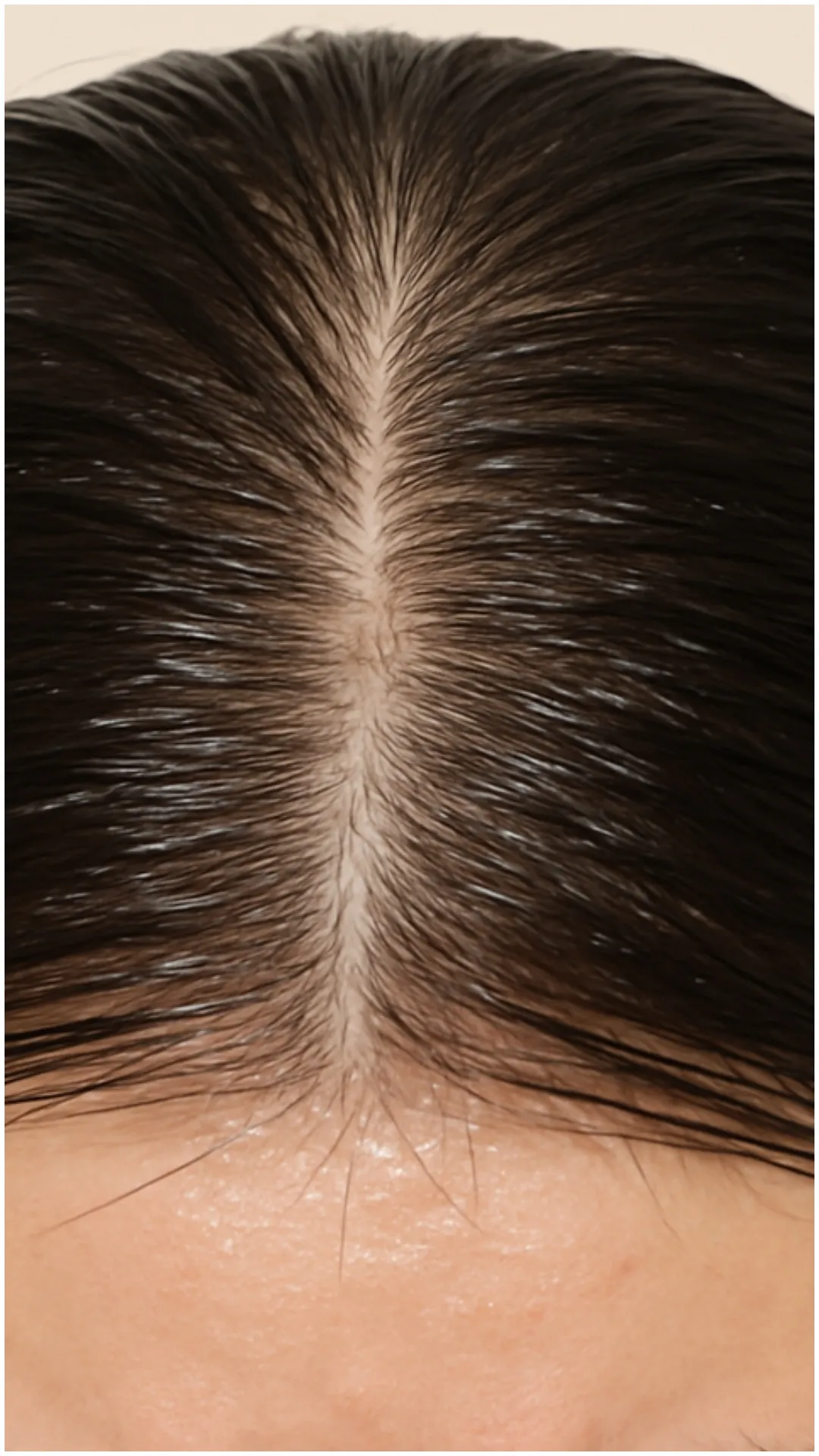 ऑयली स्कैल्प से कैसे छुटकारा पाएं?