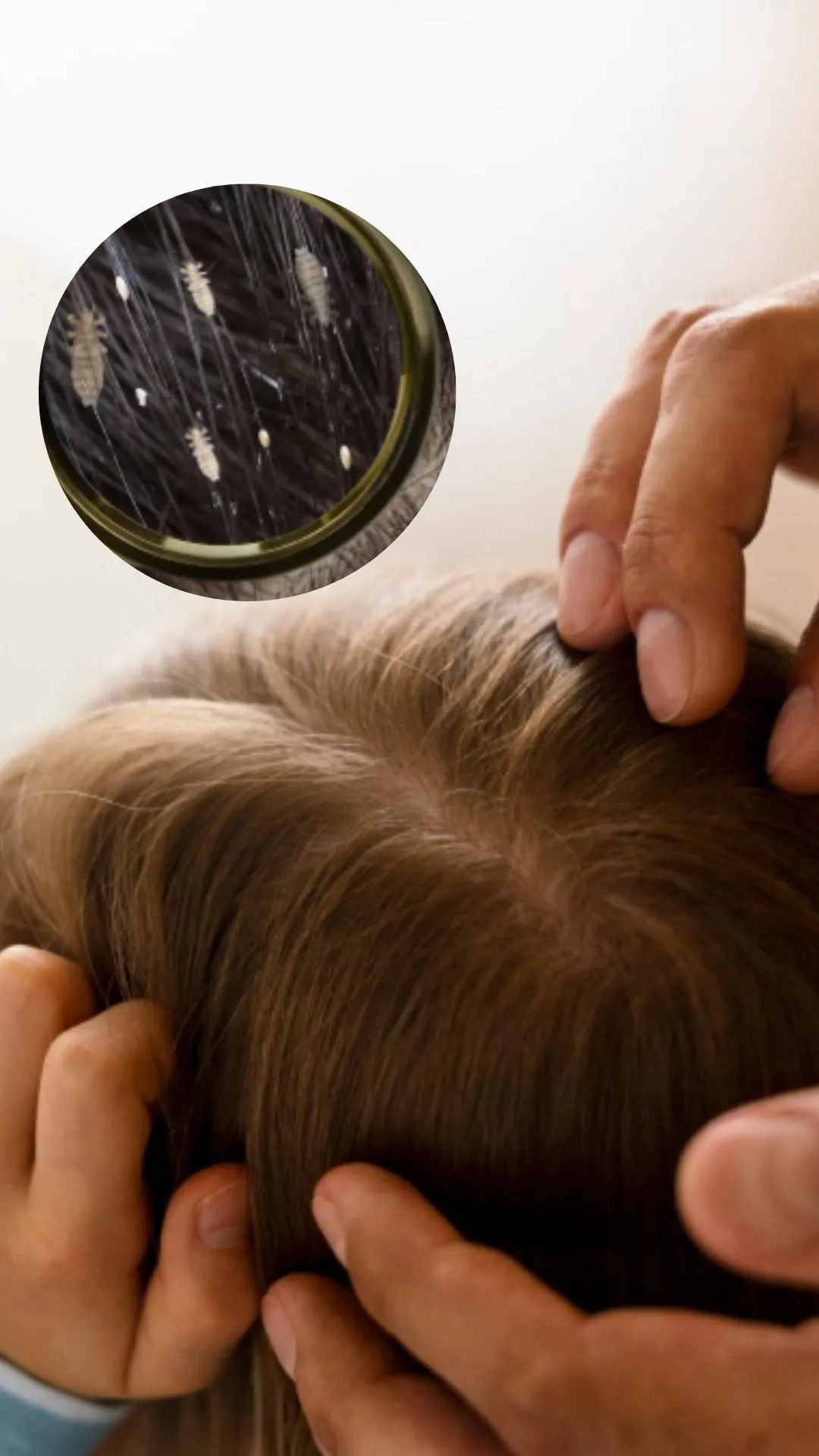 जुओं से कैसे छुटकारा पाएं?