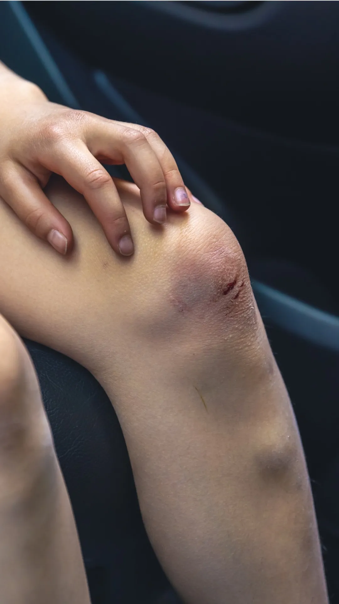 शरीर का सूजन कम करने के लिए क्या खाना चाहिए?