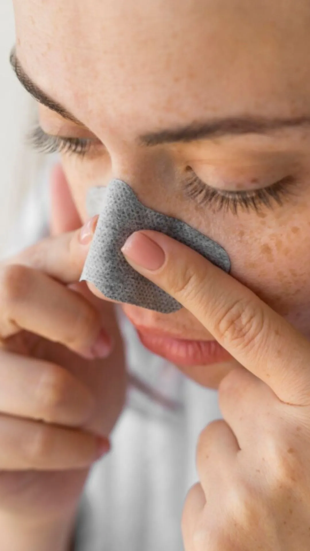 व्हाइटहेड्स हटाने के 5 सबसे असरदार घरेलू नुस्खे