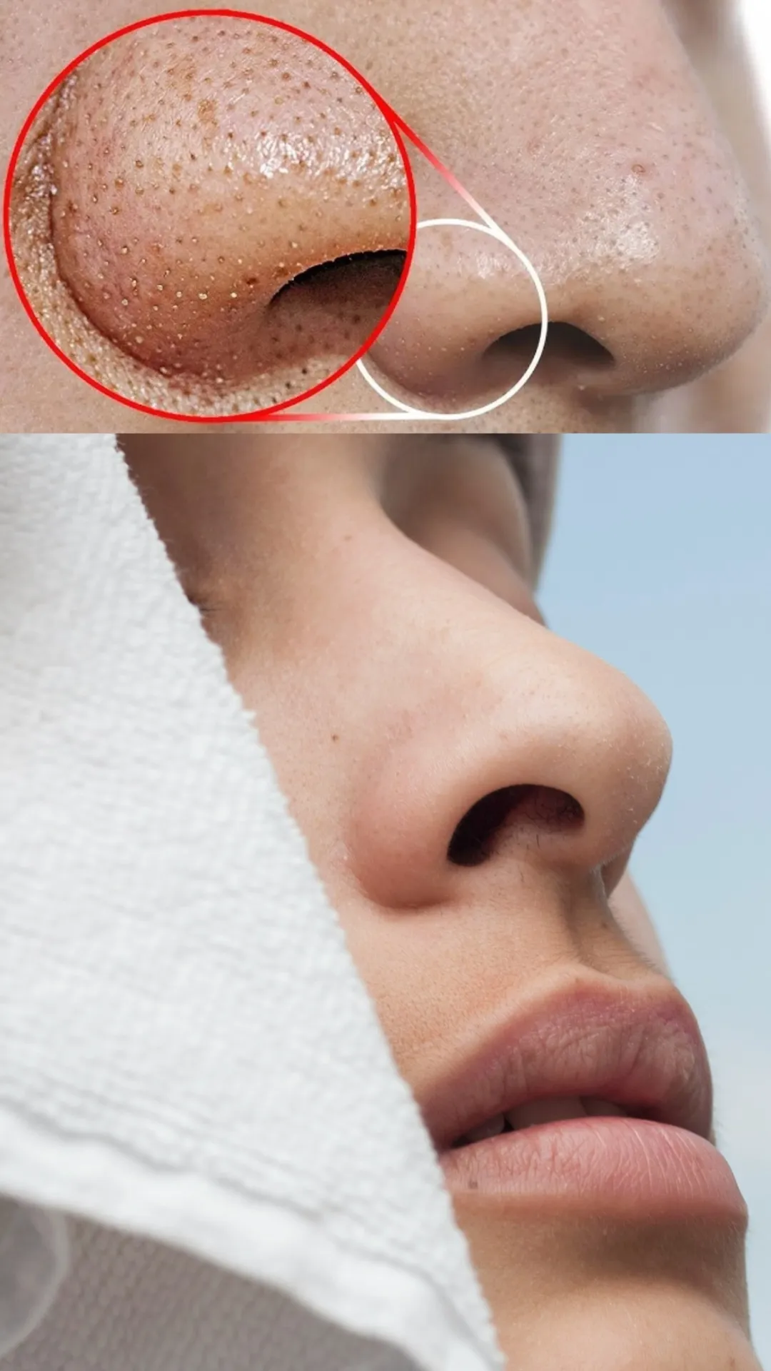 नाक का कालापन कैसे दूर करें?