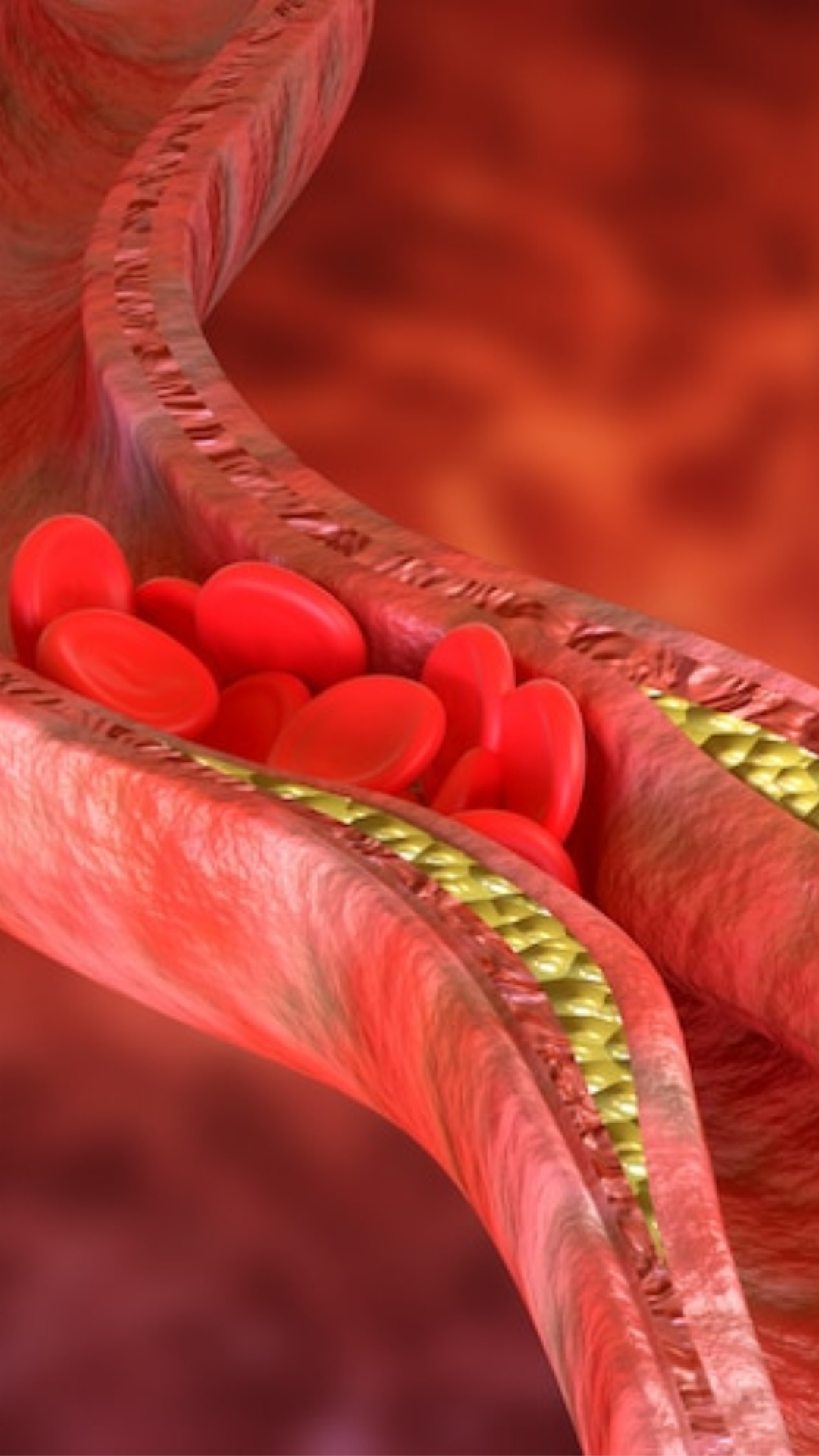 High cholesterol: कोलेस्ट्रॉल कम करने के लिए अपनाएं ये घरेलू नुस्खे