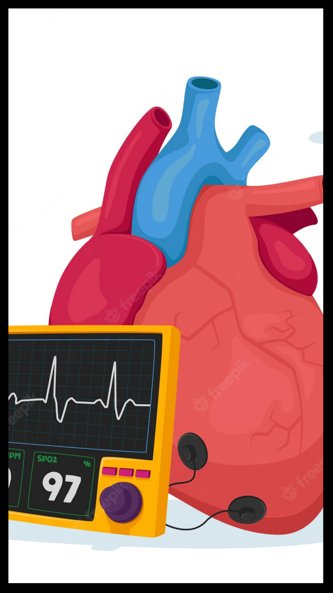 Cholesterol लेवल बढ़ने से होने लगती हैं ये परेशानियां