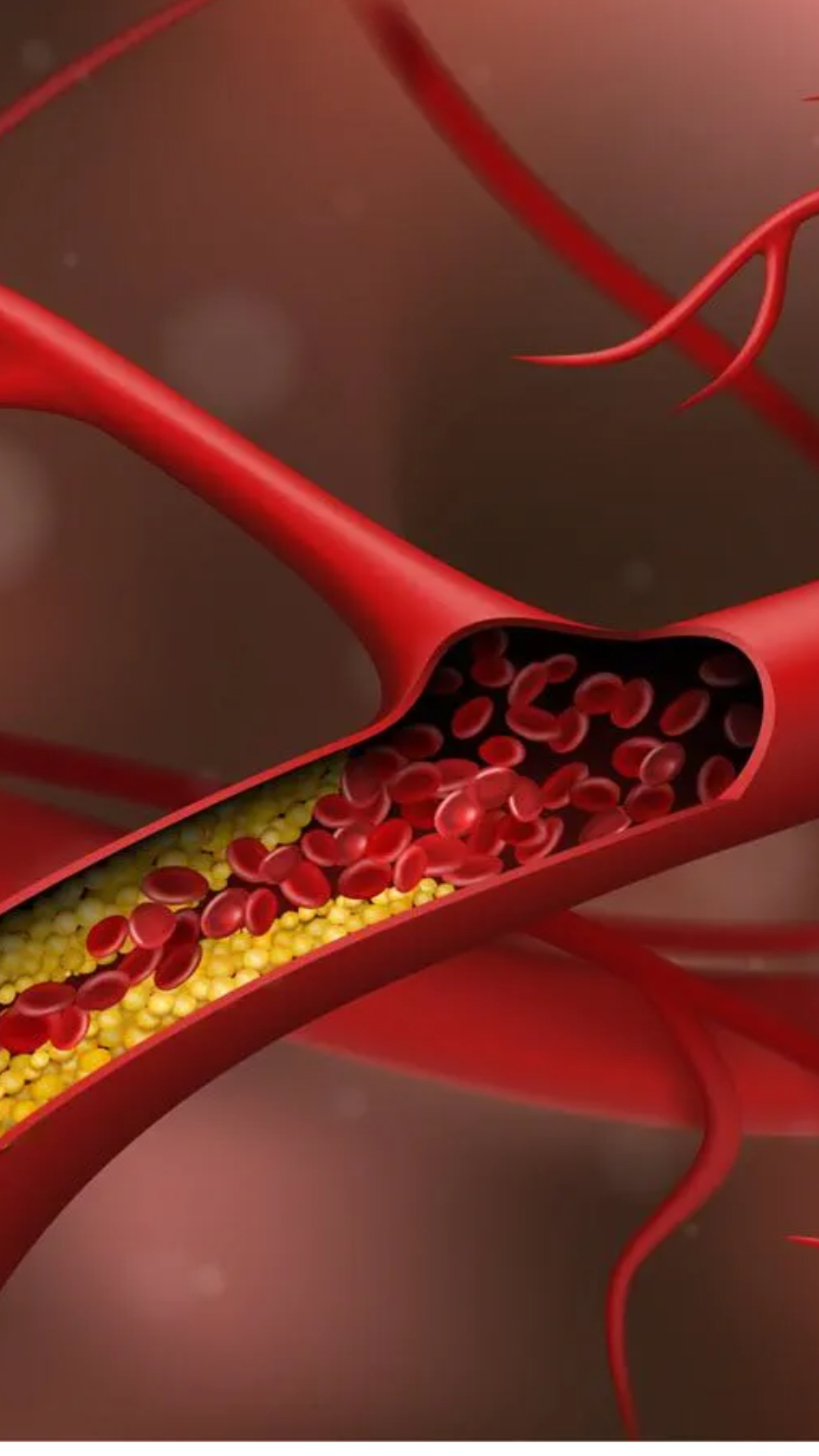 High Cholesterol: कोलेस्ट्रॉल को कंट्रोल करने ये सब्जियां डाइट में शामिल करें 