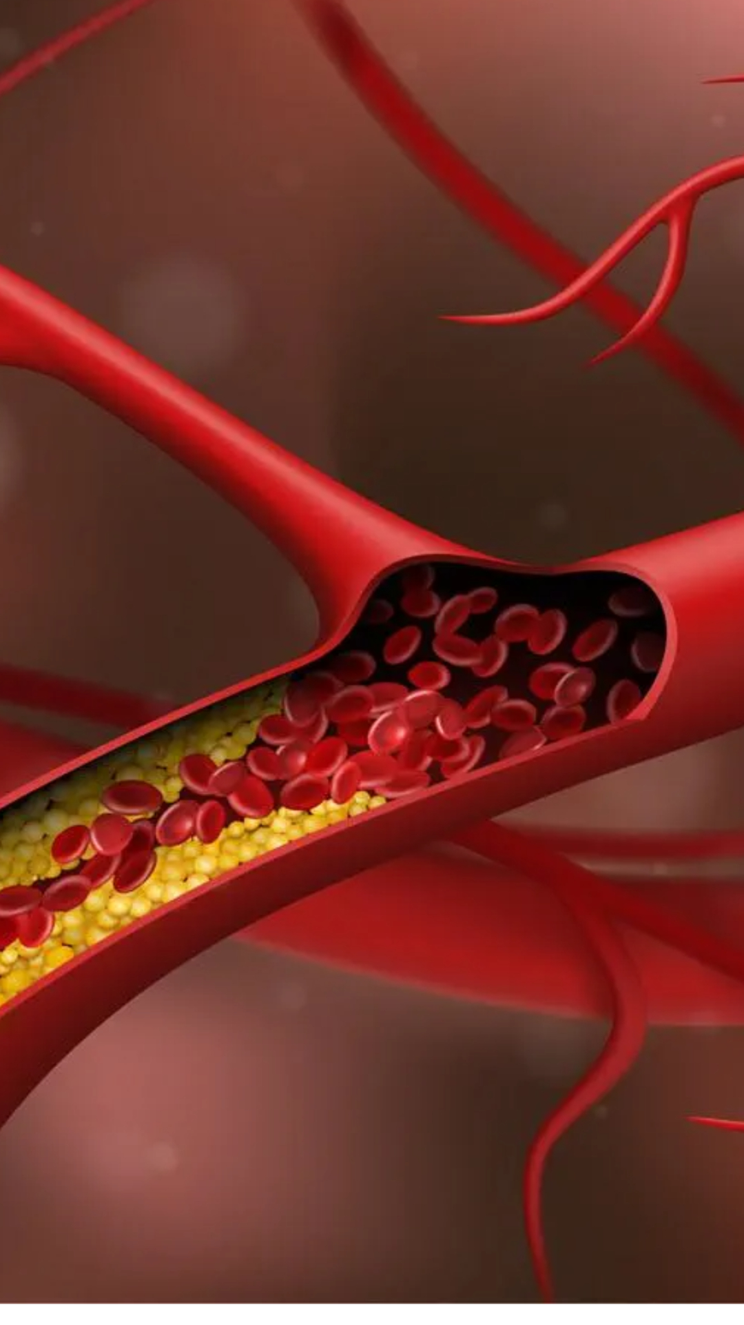 High Cholesterol: कोलेस्ट्रॉल कम करने के लिए ब्रेकफास्ट में शामिल करें ये चीजें