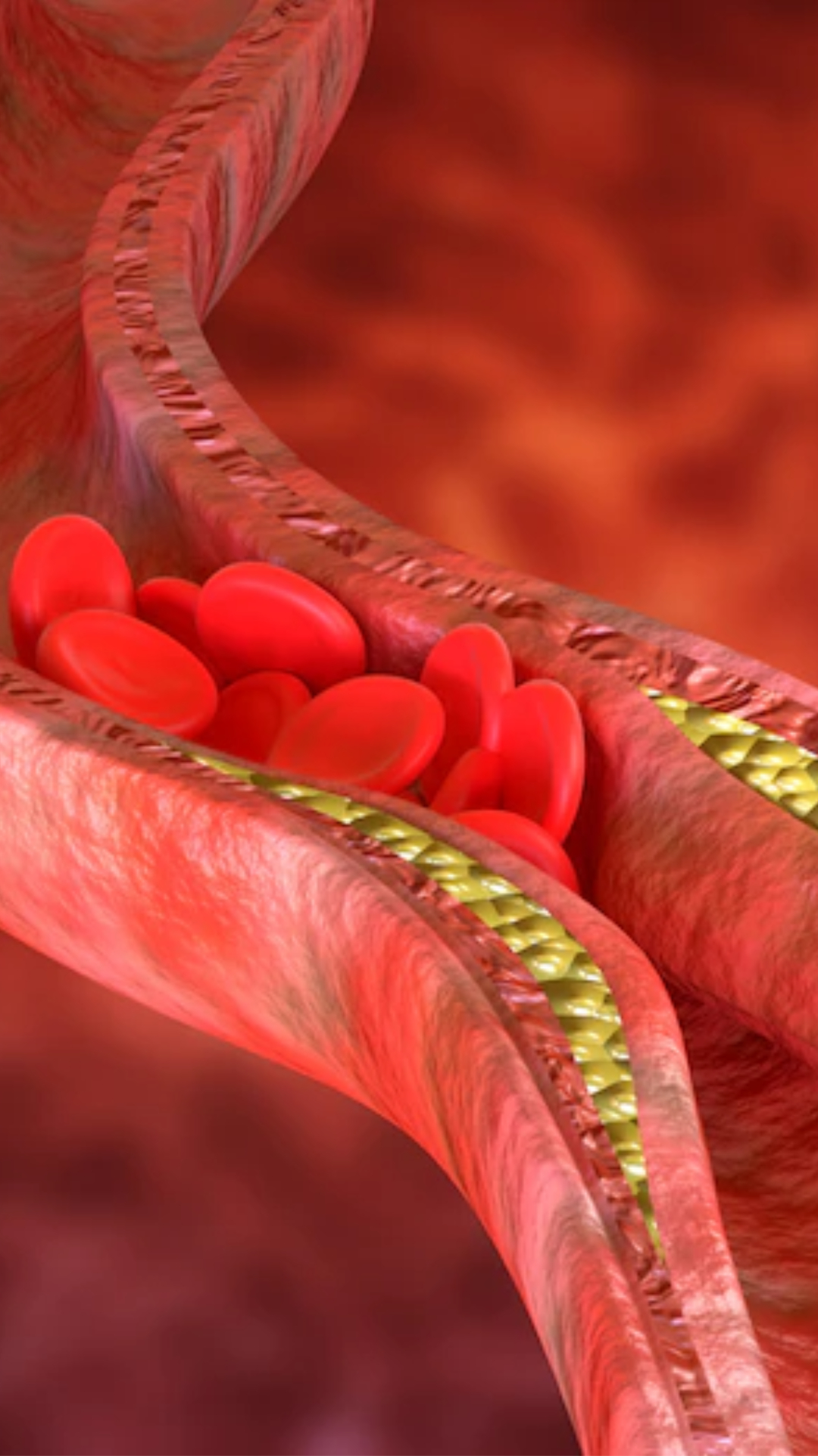 Cholesterol: हल्दी से कोलेस्ट्रॉल को कम किया जा सकता है