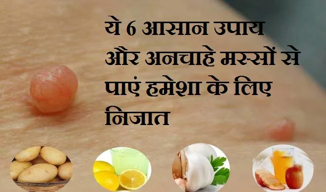 ये 6 आसान उपाय और...- India TV Hindi