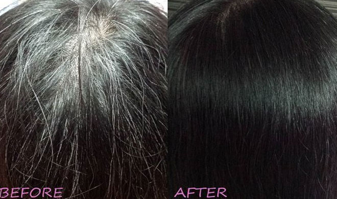 Magical oil to change white hair to black naturally turn white hair to black  permanently in 7 days guaranteed - India TV Hindi