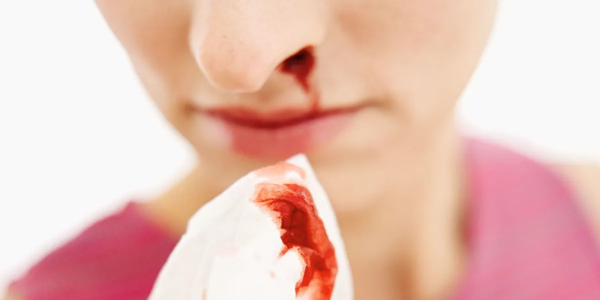 सावधान! नार्मल न समझें नाक से खून आना, हो सकते है ये जानलेवा कारण <p>Nose bleeding</p>- India TV Hindi