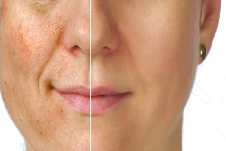 चेहरे के पोर्स को करना है ठीक तो दूध और ओट्स का इस तरह करें इस्तेमाल <p>skin care tips</p>- India TV Hindi