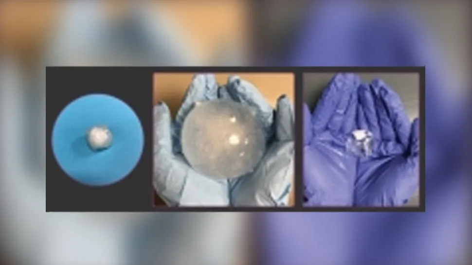 अब ये छोटी सी गोली दिलाएं कैंसर और अल्सर से निजात, खाने के बाद आपके पेट में करेंगे ये काम tablet for ulcer and Colon cancer - India TV Hindi