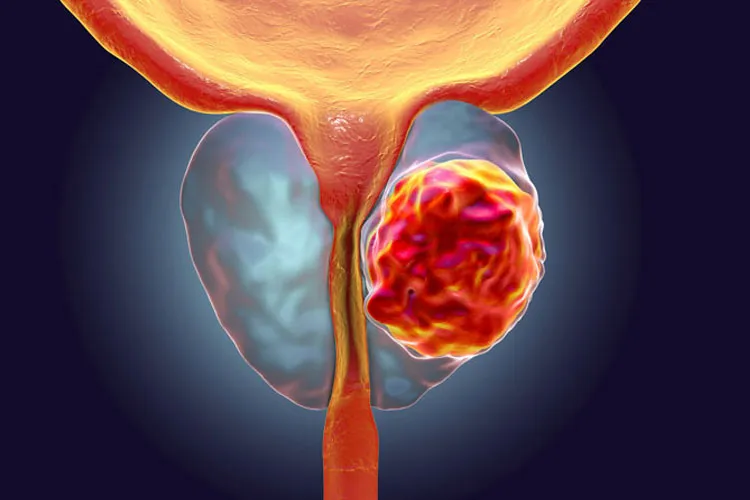 देश में बढ़ता जा रहा है इस बीमारी का खतरा, जानिए इसके बारे में <p>cancer</p>- India TV Hindi