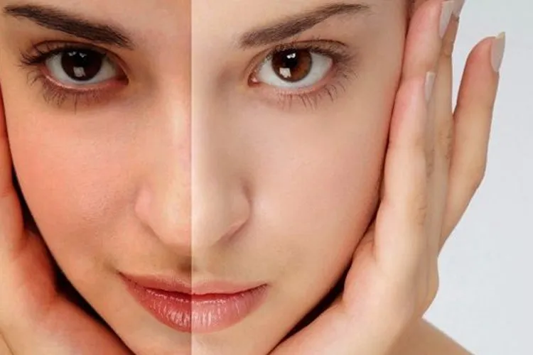 15 मिनट में स्किन टैन को करें खत्म, घर में बनाए नींबू और खीरे का पेस्ट <p>skin tanning</p>- India TV Hindi