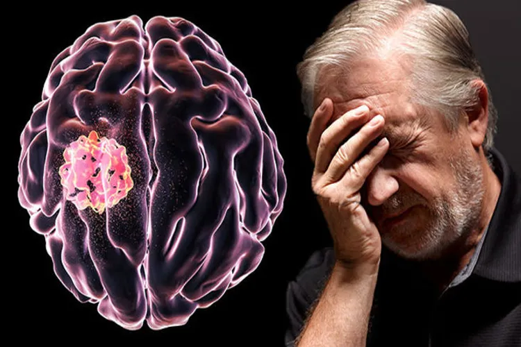 शरीर में दिखें ये लक्षण तो हो सकता है ब्रेन ट्यूमर, इस तरह रखें ख्याल <p>Brain Tumor</p>- India TV Hindi