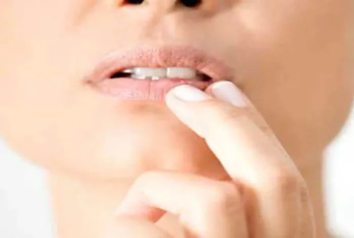 मुंह के छालों से पाना है छुटकारा तो दवा छोड़ इन नुस्खों को आजमाइए mouth ulcer treatment in hindi- India TV Hindi