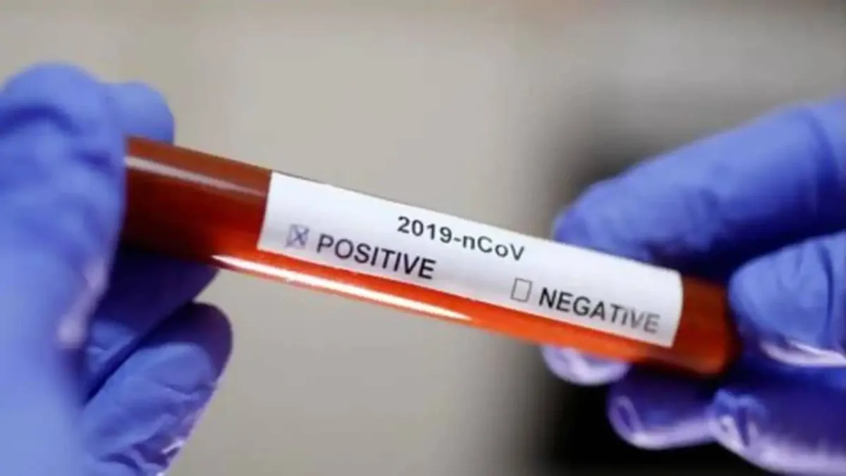 पश्चिम बंगाल में पिछले 24 घंटे में कोरोना वायरस के 454 नए मामले सामने आए Coronavirus cases in West Bengal till 13th June- India TV Hindi