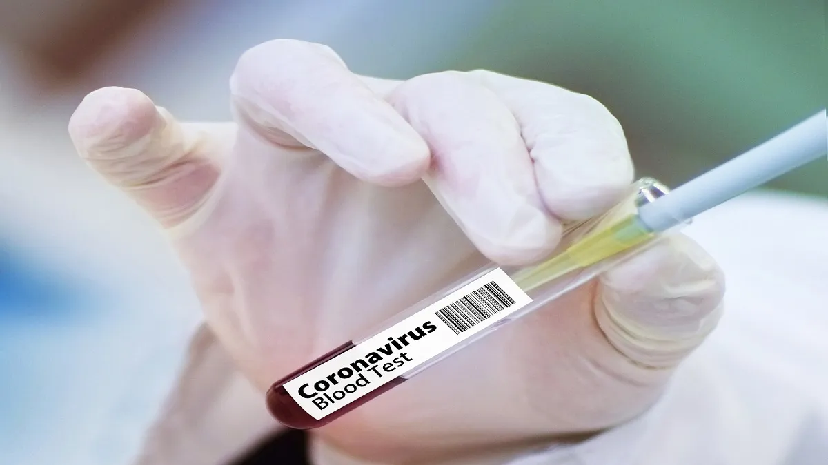 पश्चिम बंगाल में कोविड-19 के 895 नए मामले सामने आए, 21 और मरीजों की मौत Coronavirus cases in West Bengal till 5th July - India TV Hindi