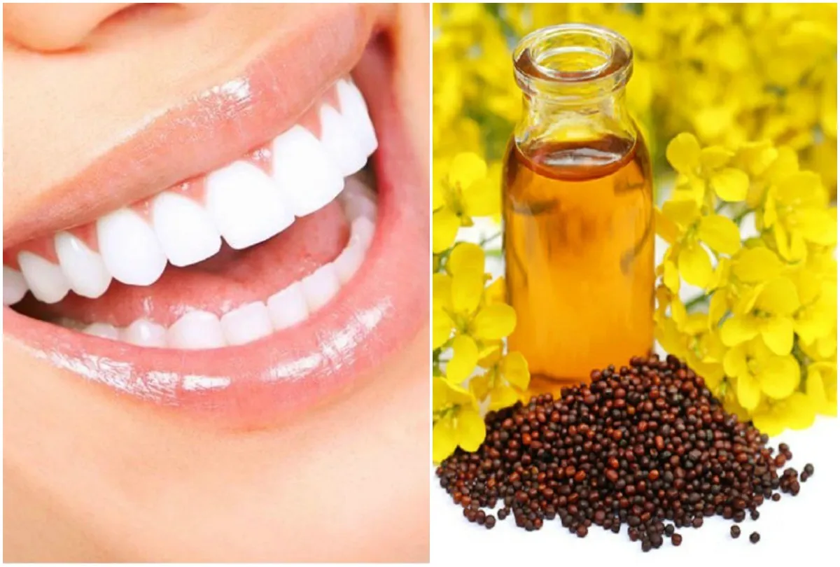 दांतों का पीलापन चंद दिनों में दूर करेगा ये तेल, बस रोजाना इन चीजों को मिलाकर करें मसाज Teeth and Mustard oil- India TV Hindi