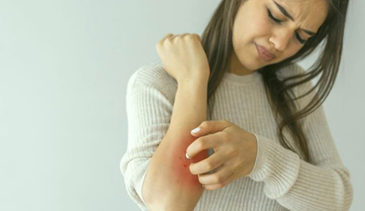 Home remedies for treating skin itching in the rainy season in hindi