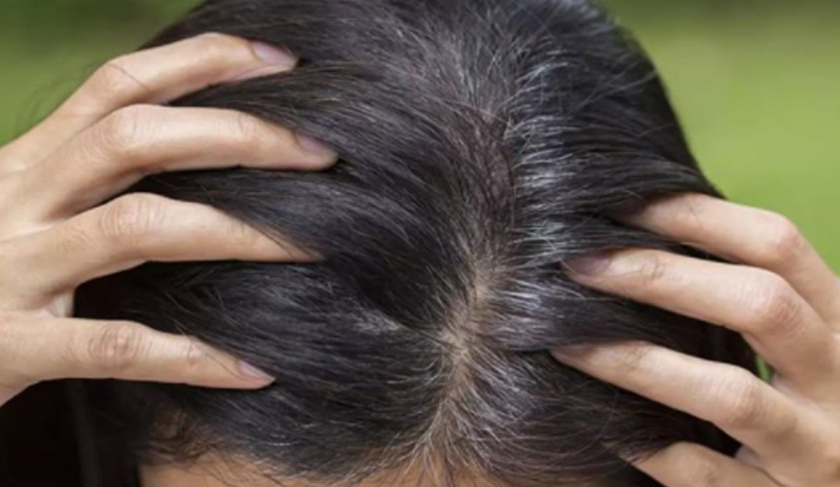 Bhringraj For Grey Hair: How To Use Bhringraj And Coconut Oil Paste For White Hair Naturally In Hindi: सफेद बालों को एक सप्ताह में काला कर देगा भृंगराज, बस ऐसे करें इस्तेमाल - Bhringraj For Grey Hair: How To Use Bhringraj And Coconut Oil Paste For White Hair Naturally In Hindi: सफेद बालों को एक सप्ताह में काला कर देगा भृंगराज, बस ऐसे करें इस्तेमाल -