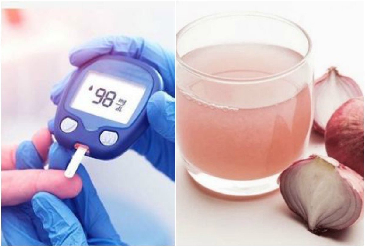 onion juice Instant control Diabetes onion juice control Diabetes patient sugar level naturally