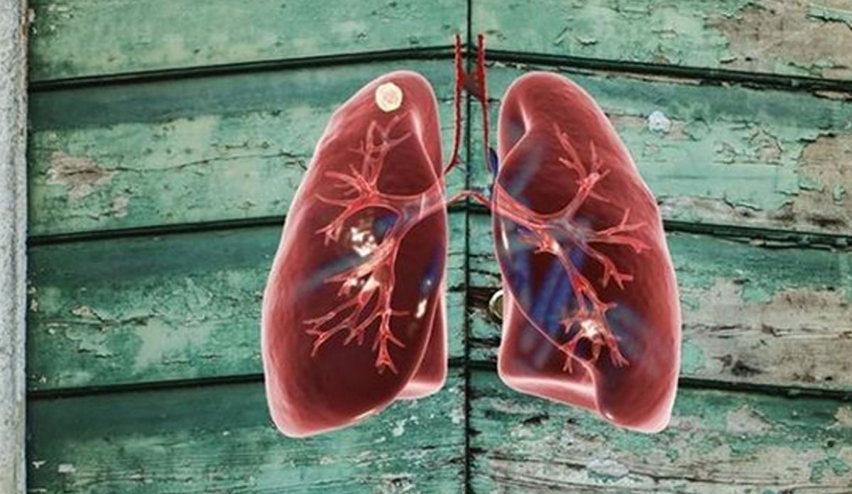 Garlic for tb know to use garlic and walnut to cure tb or Tuberculosis