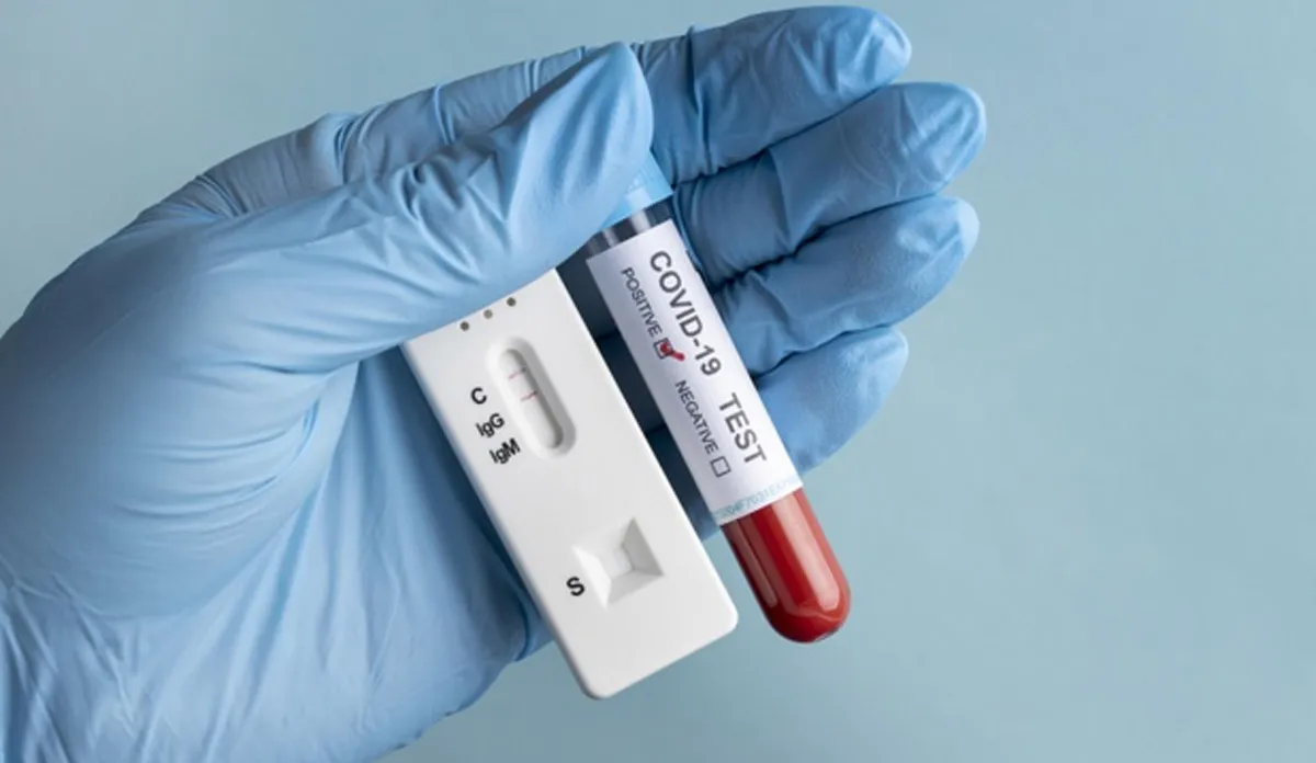Coronavirus Live: ब्लैक फंगस के लिए मुस्तैद हो रही हैं सरकारें, हरियाणा में तैयार हुए वार्ड्स Coronavirus Live: स्मोकिंग करने वाले और शाकाहारी लोगों में कोविड-19 का खतरा कम, जानिए इस दावे की सच्- India TV Hindi