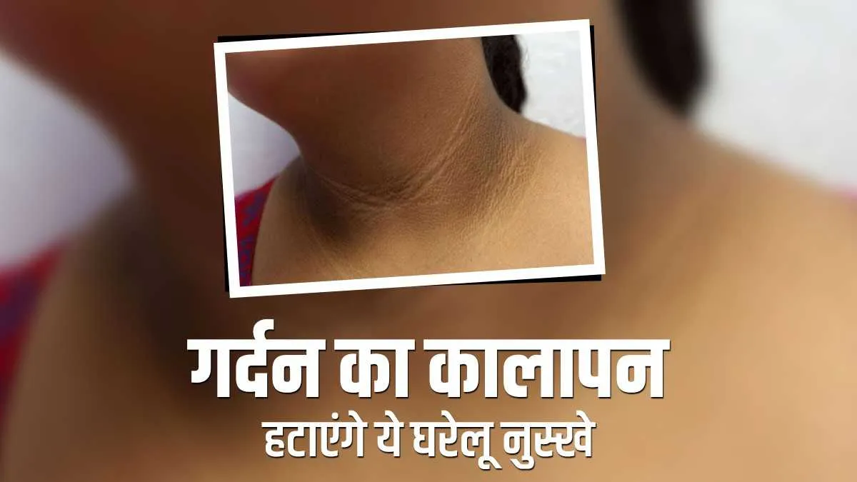 गर्दन का कालापन दूर करने के घरेलू नुस्खे, जल्द मिलेगा छुटकारा dark neck- India TV Hindi