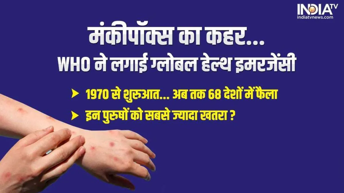 Monkeypox: WHO ने घोषित किया 'ग्लोबल हेल्थ इमरजेंसी', 1970 में मिला पहला केस, इन पुरुषों पर कर रहा अटैक, जानिए A टू Z सबकुछ Monkeypox Virus Outbreak - India TV Hindi