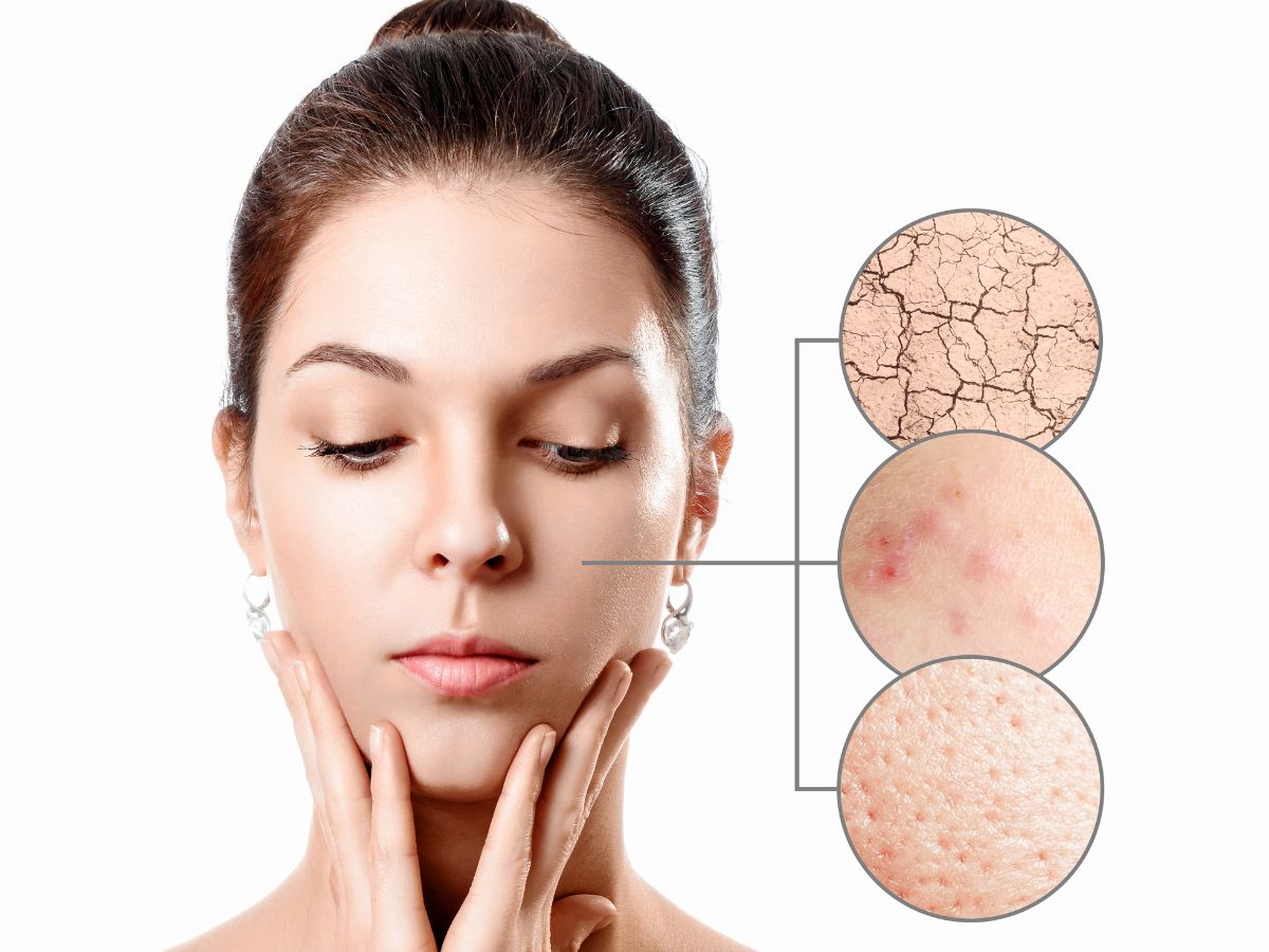 Dry Skin Vitamin Deficiency सर्दियों में इन विटामिन की कमी से स्किन हो