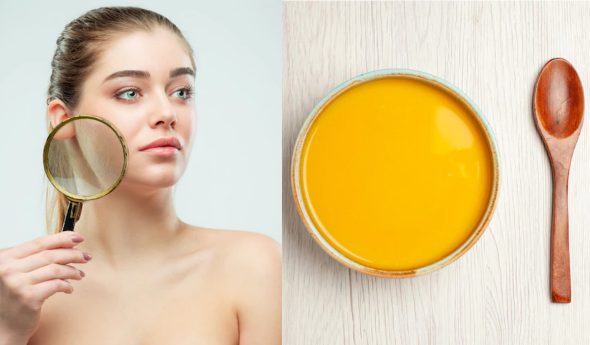 Dry Skin Problems In Winter Fine Lines Use Desi Ghee Home Remedies 