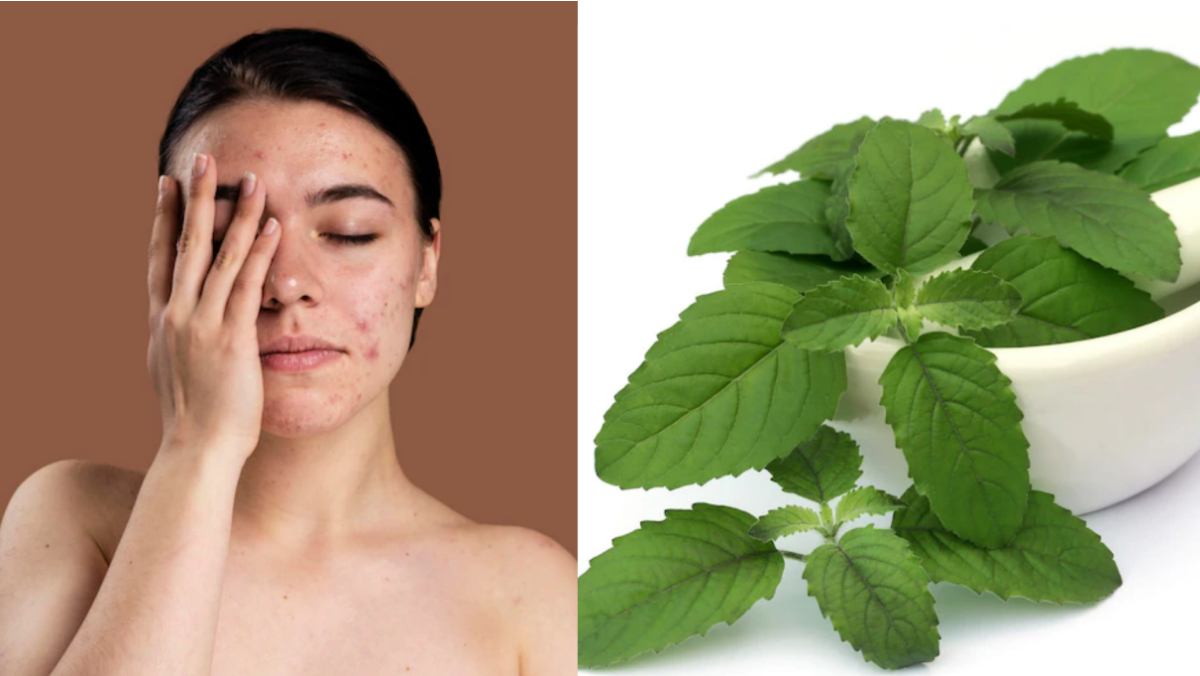 Skin care tips tulsi face pack remove acne pipmples and other skin problem