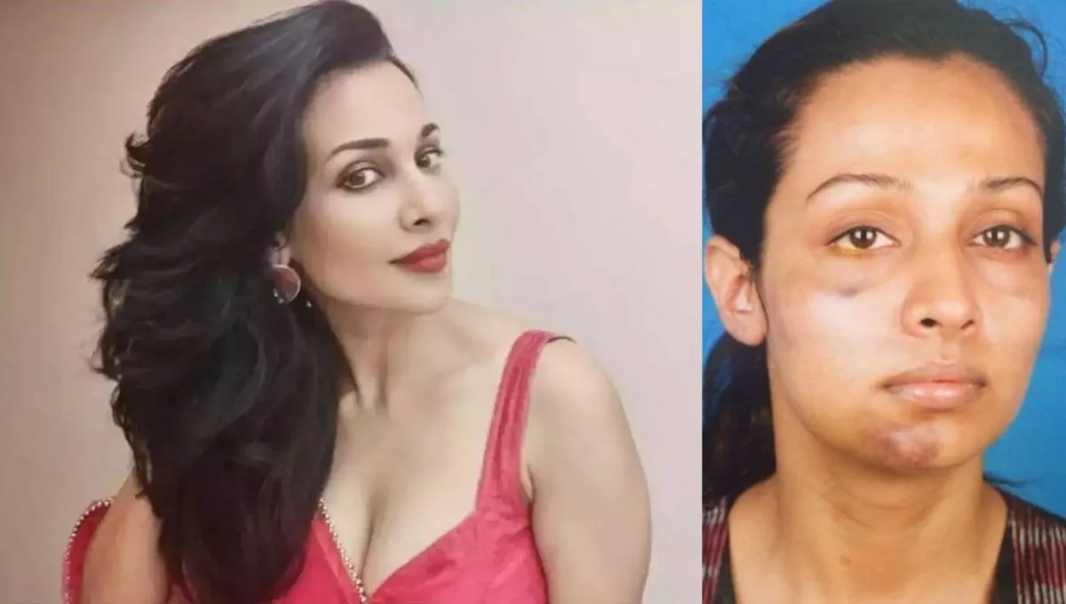 फ्लोरा सैनी के एक्स बॉयफ्रेंड ने की थी बेरहमी से पिटाई, एक्ट्रेस आपबीती सुनाकर बोलीं- लगभग मार ही डाला था Flora Saini- India TV Hindi