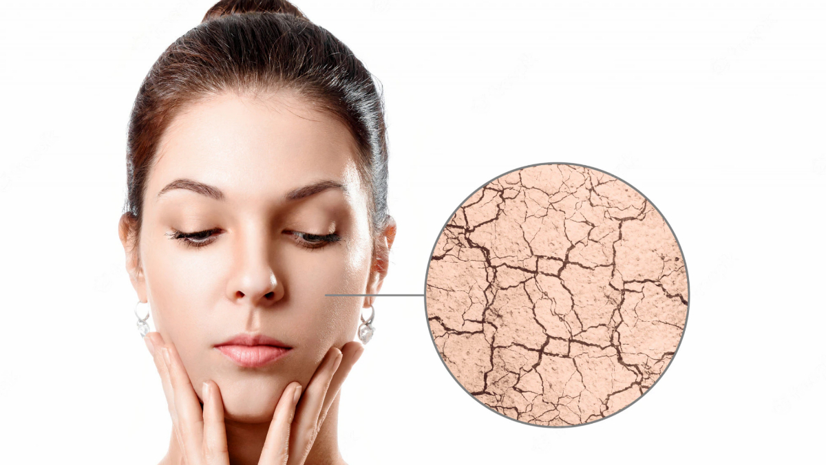 ड्राई स्किन के लिए घरेलू उपाय स्किन केयर रूटीन में करें ये 4 बदलाव