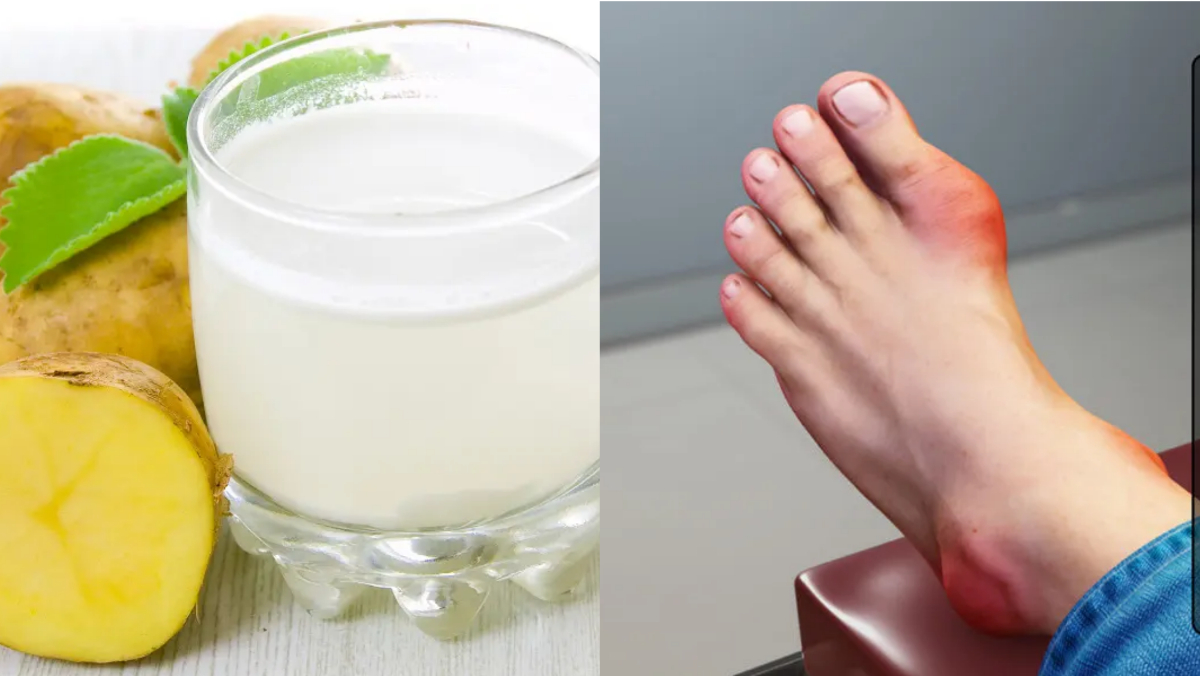 यूरिक एसिड में आलू का जूस पीने के फायदे Potato juice benefits for