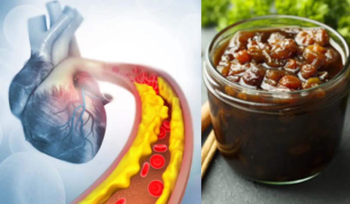 कोलेस्ट्रॉल को छानकर बाहर कर देती है इस चीज की चटनी, दिल के मरीजों को कभी नहीं आएगा हार्ट अटैक cholesterol - India TV Hindi