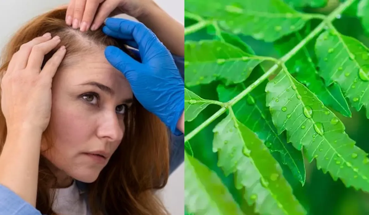 बालों को झड़ने से बचाती हैं नीम की पत्तियां, ऐसे इस्तेमाल करने से हेयर को मिलते हैं अनगिनत फायदे neem ke patte ke fayde- India TV Hindi