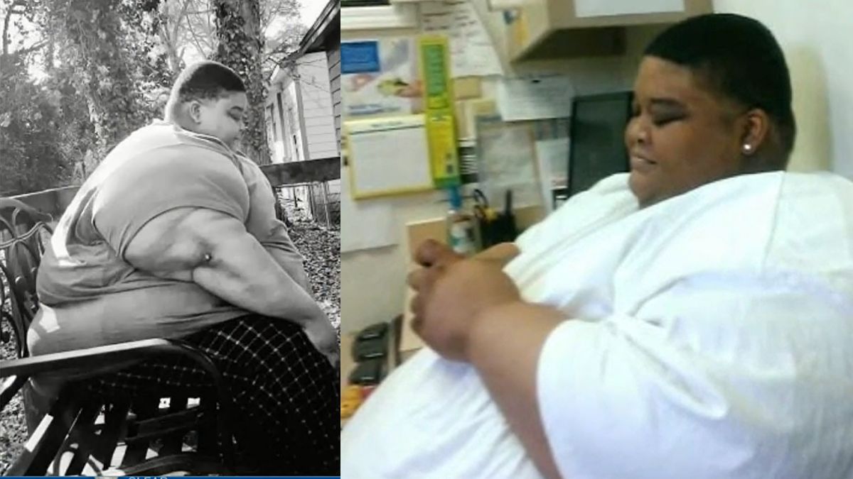 The doctor said – you will die in 3 to 5 years, then this person reduced the weight of 165 kg