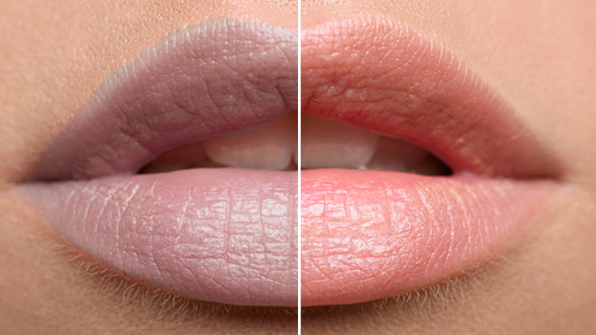 It is not a difficult task to make black lips pink, just include these 3 things in the diet