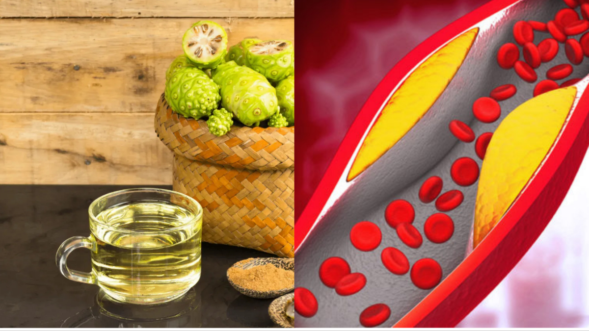 हाई कोलेस्ट्रॉल में नोनी जूस के फायदे High cholesterol Noni Juice in