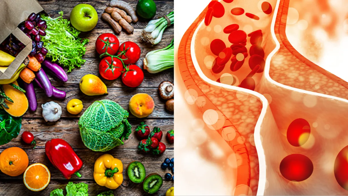 नसों में जमे बैड कोलेस्ट्रॉल को बर्फ की तरह पिघला देंगे ये फल और सब्जियां, नॉन स्टॉप दौड़ेगा शरीर में खून cholesterol- India TV Hindi